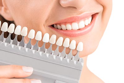 Ästhetische Zahnmedizin wie Zahnaufhellung (Bleaching) oder Korrekturen